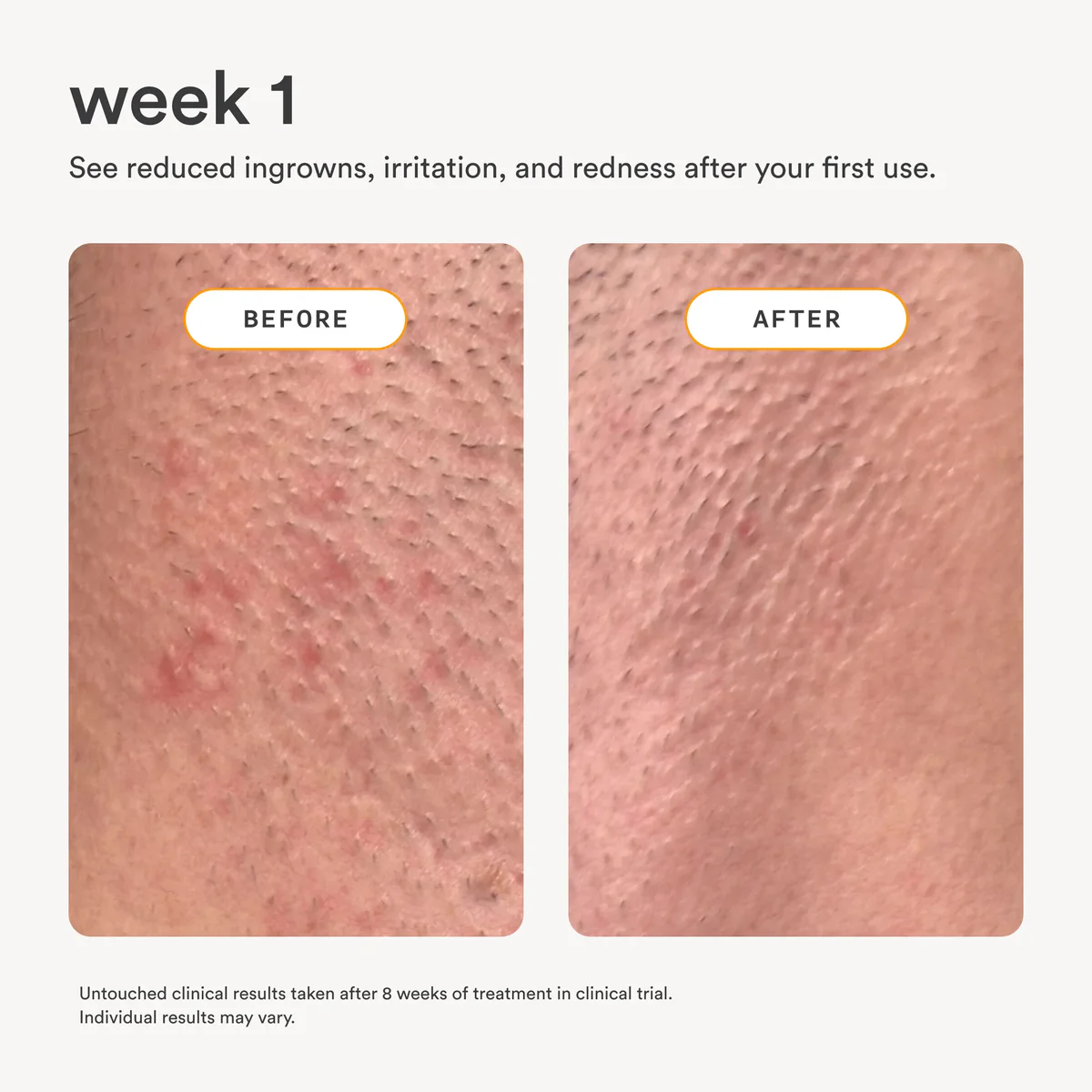 The Shave Kit - Image 5